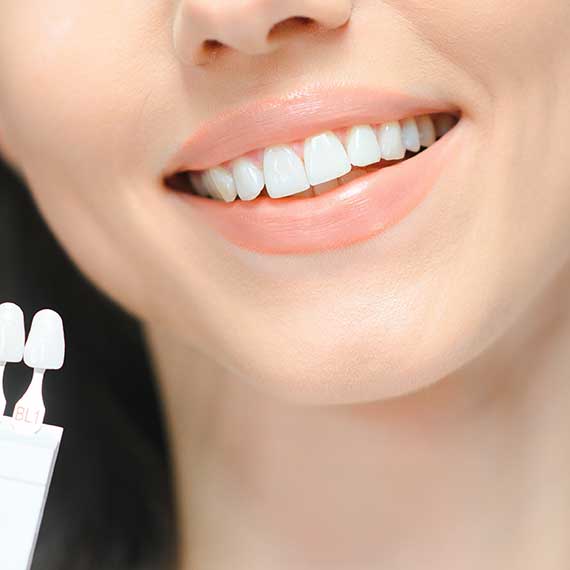 שיניים - פרופסור רפי קרסו